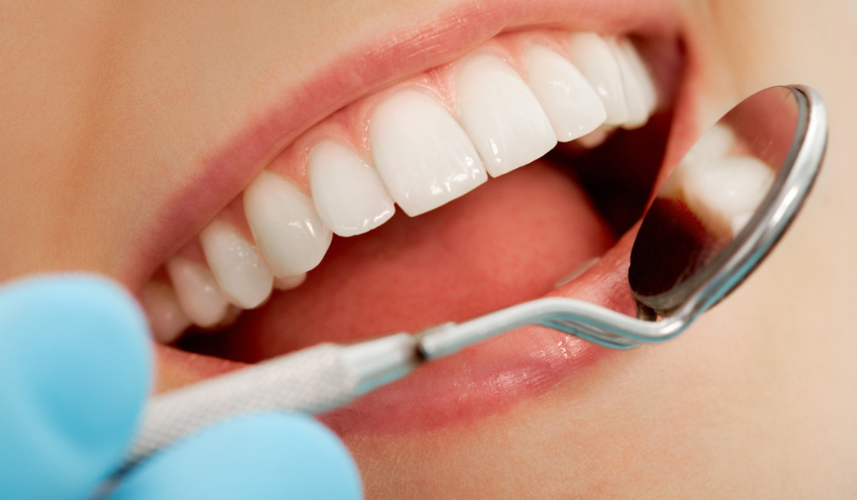 La polizza UniSalute: assicurazione dentale